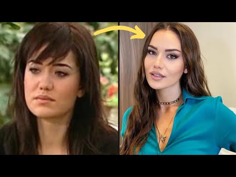 ТОП 15 Турецких Актрис До и После Пластики — Ты Узнаешь Их?