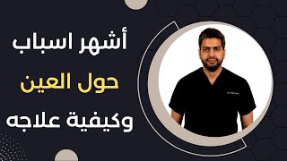 انحراف النظر أو الحول ما هو وما أسبابه وطرق علاجه | د.أحمد اسامة