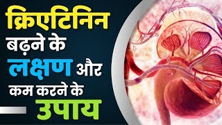 जानिए क्रिएटिनिन बढ़ने के लक्षण और कम करने के उपाय | Creatinine Level in Dialysis Patients जानिए क्रिएटिनिन बढ़ने के लक्षण और कम करने के उपाय | Creatinine Level in Dialysis Patients