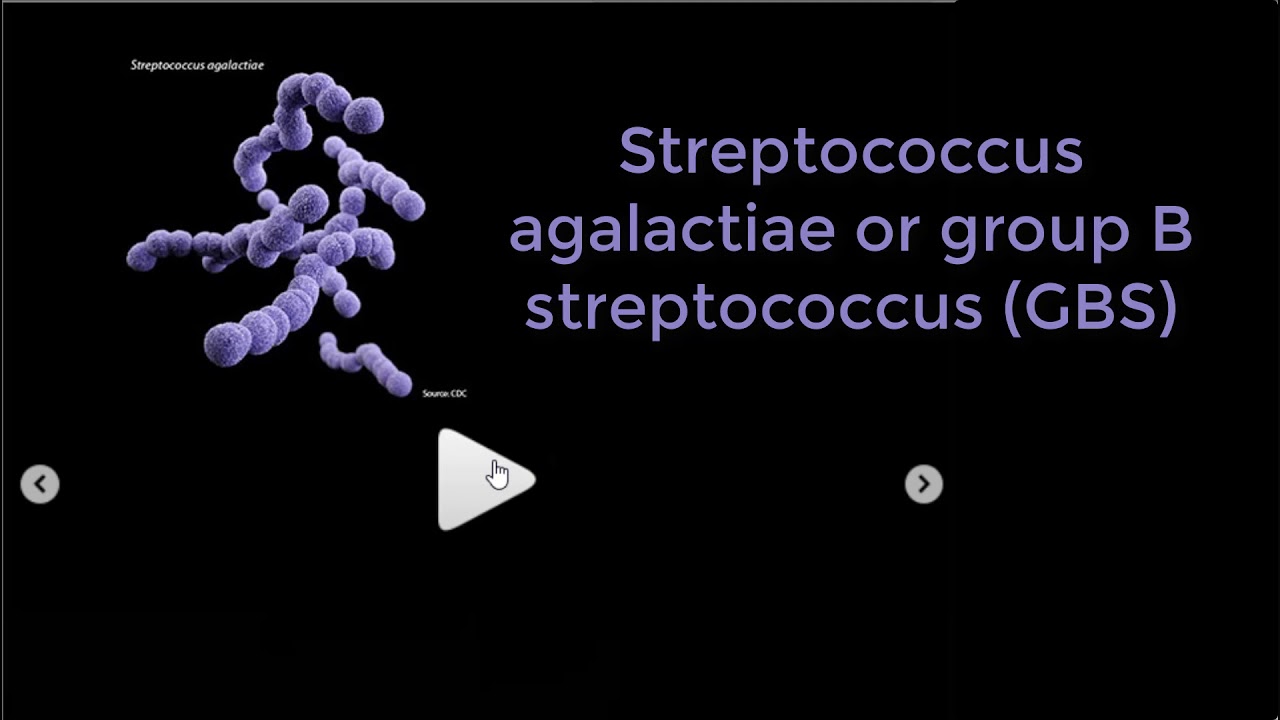 Streptococcus agalactiae – Wikipédia, Streptococcus agalactia férfiak kenetében