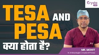 Download Lagu TESA and PESA क्या होता है? | What is Surgical Sperm Extraction? | Crysta IVF MP3