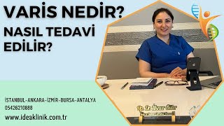 Varis Nedir, Belirtileri yada Şikayetleri Nelerdir? - Op. Dr. İlknur Güler - IDEA Klinik Resimi