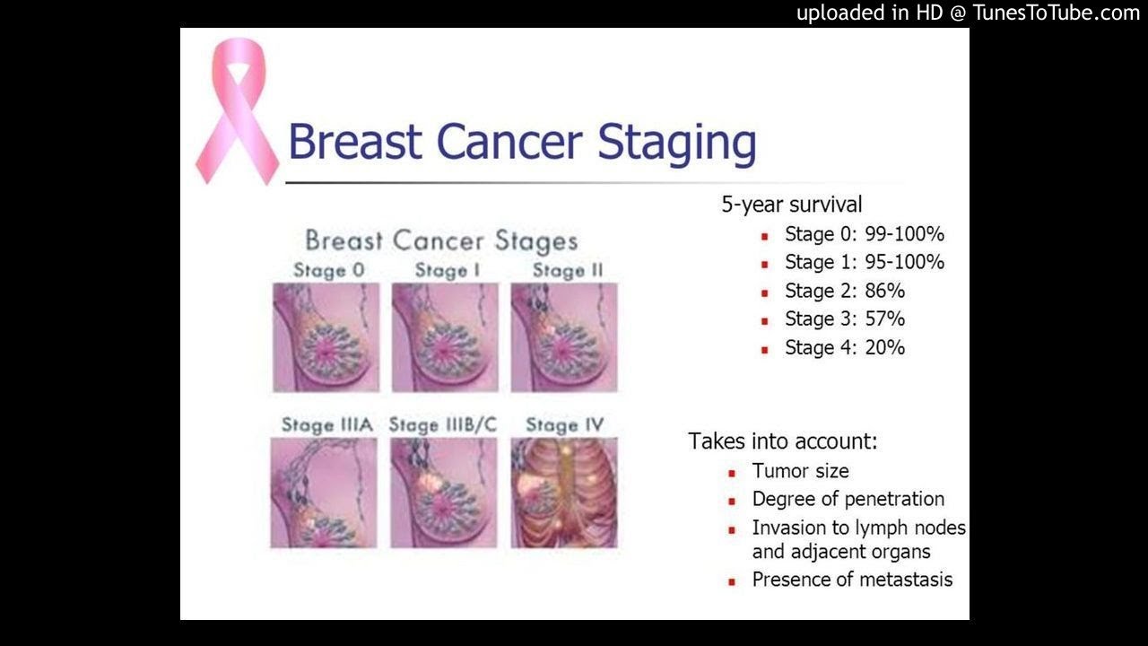 Stage Iv Metaplastic Breast Cancer In Which Primary Tumor Was Removed