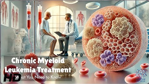Chronic Myeloid Leukemia: Breakthrough Therapies You Should Know