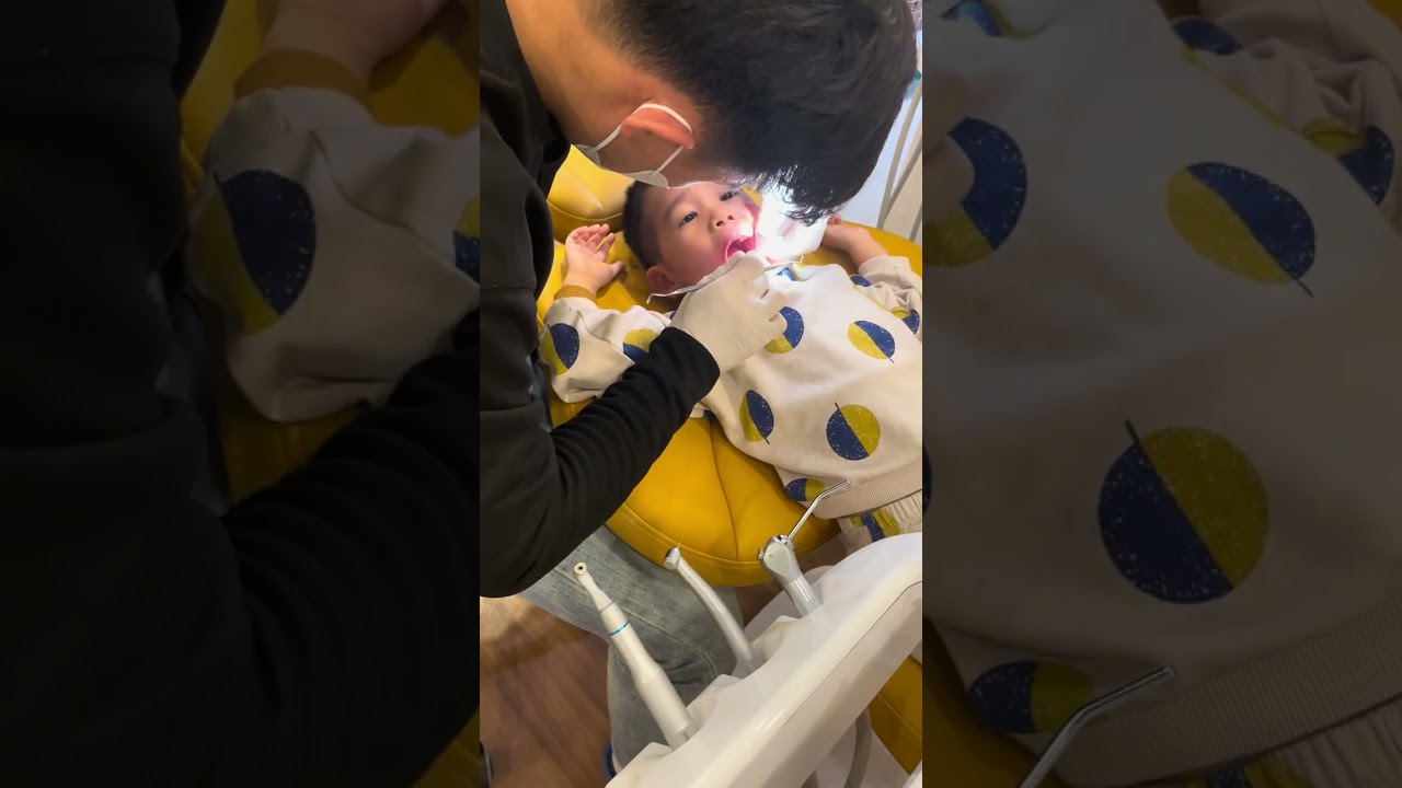 Kiến 3.5T lần đầu đi nha khoa hàn răng hàm sâu