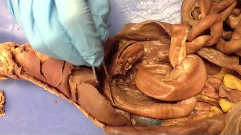 Emily Z. & Emily C. Digestive System