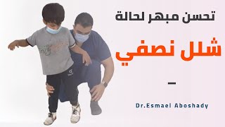 تحسن مبهر لحالة شلل نصفي | Hemiplegia Case