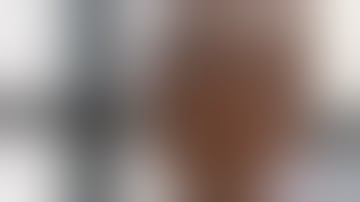 Mazor X Stealth Edition TLIF Procedural/Instructional Video