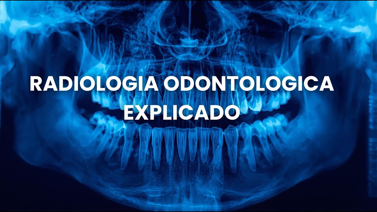 RADIOLOGIA ODONTOLOGICA - EXPLICADO