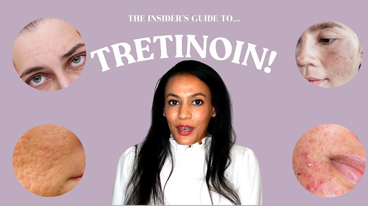 What does tretinoin do to your skin