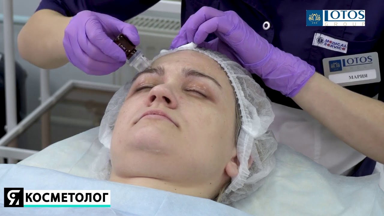 EYE CON - уход за кожей вокруг глаз