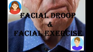 AFTER STROKE: Facial Drooping & Facial Exercises