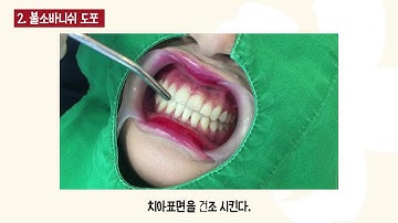 불소란 무엇인가, 해운대 예쁜미소바른이치과 불소이야기