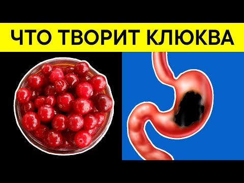 Video: Черники кислоталуубу же негиздүүбү?