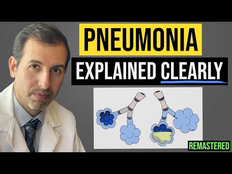 Video: Bilateral Pneumonia In Adults And Children - Symptoms, Treatment