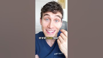 Surprising Reasons You Have Dark Circles!