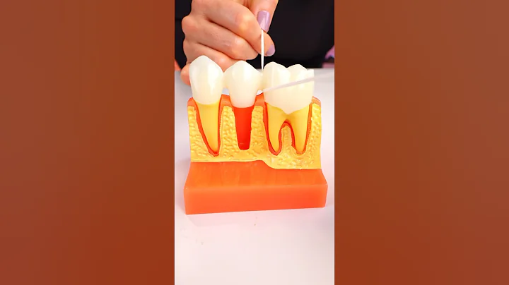 How To Floss Under A Bridge