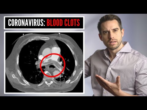 Are BLOOD CLOTS the reason why COVID patients are dying? | Blood thinners to save lives?