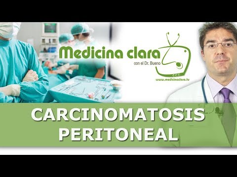 Vídeo: La carcinomatosi peritoneal és mortal?