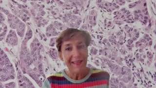 UTUC and bladder carcinoma: are similarities greater than differences?
