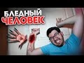 Заказал БЛЕДНОГО ЧЕЛОВЕКА с Даркнета ! пробил ему гл*з ! Бледный человек в реальной жизни