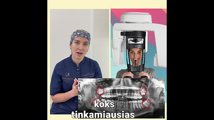 Ką iš tikrųjų daryti su protiniais dantimis⁉️