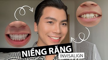 #9 - Niềng Răng Invisalign Tại Đức | Nên Hay Không ???