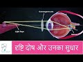 दृष्टि दोष और उनका निवारण