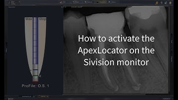 Sidexis 4 and Sinius - Plugin Configuration