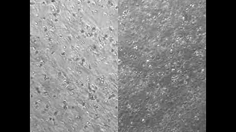 The influence of GelMA hydrogel stiffness on cell spreading