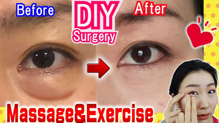 How to Remove Under Eye Bags👁️ Naturally in 7 Days Massage & Exercises🙋