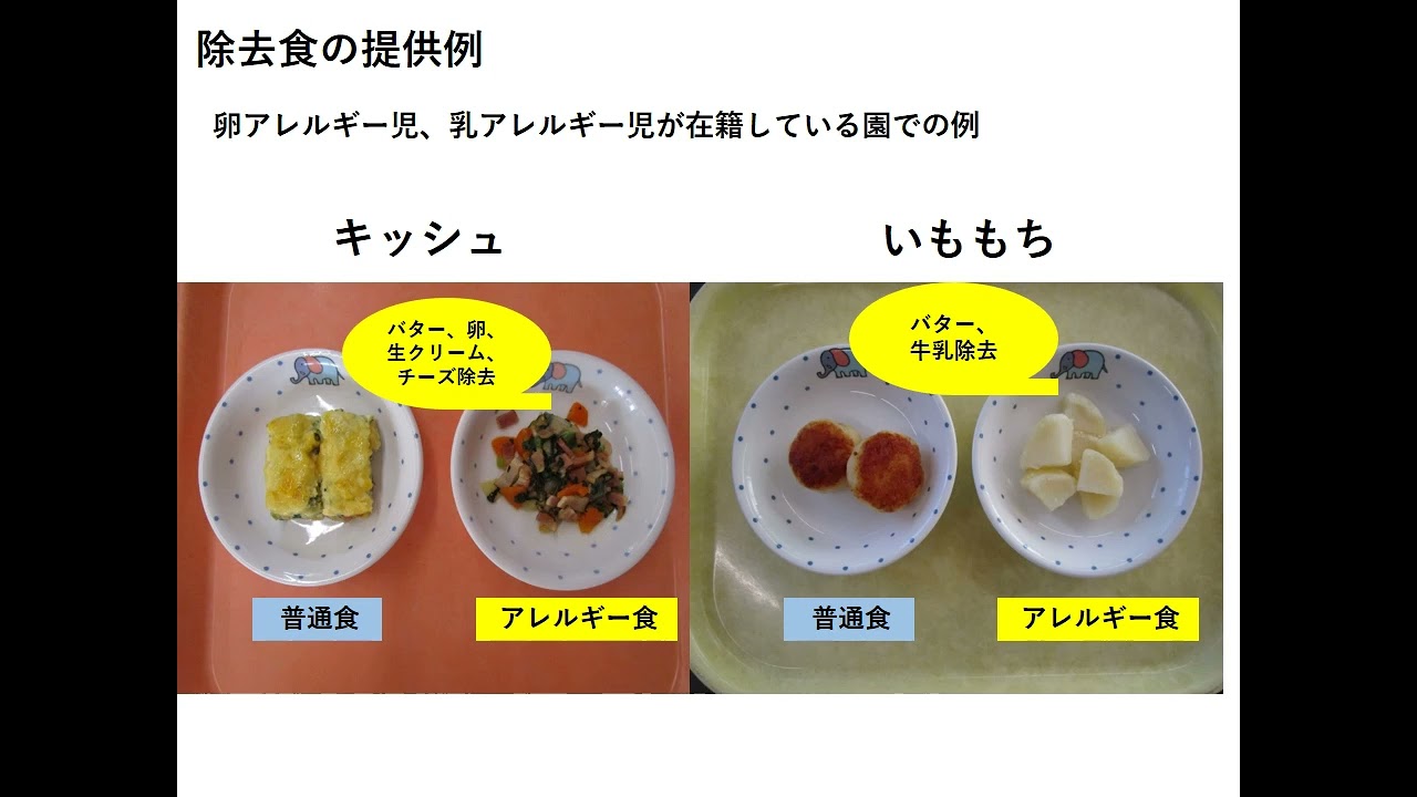 ３．保育所等における食物アレルギー対応について