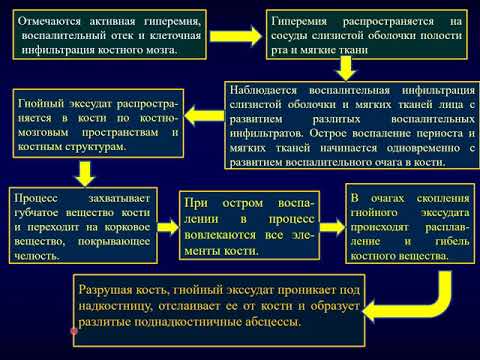 Острый одонтогенный остеомиелит челюстных костей у детей