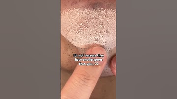 How to make HUGE pores look smaller with Korean skincare #koreanskincare #korea #skin1004 #skincare
