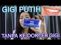 PENDAPAT SAYA SOAL WHITESTRIPS PEMUTIH GIGI YANG DIJUAL BEBAS (WHITENING STRIPS)