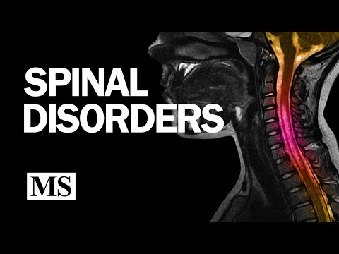 Spinal Disorders