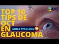 Top 10 Tips de OCT en Glaucoma