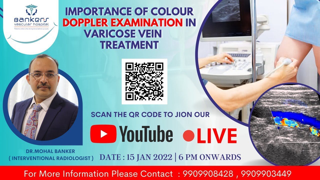 Vaginal varicose vein  best hospital for varicose veins treatment in  Ahmedabad, India 