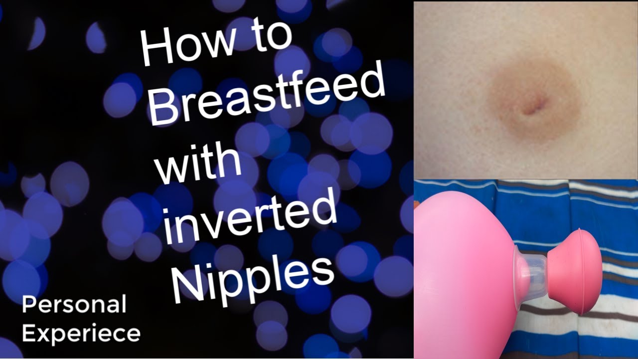How To Breastfeed With Inverted Nipples Youtube
