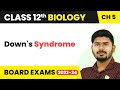 Down's Syndrome - Principles of Inheritance and Variation | Class 12 Biology