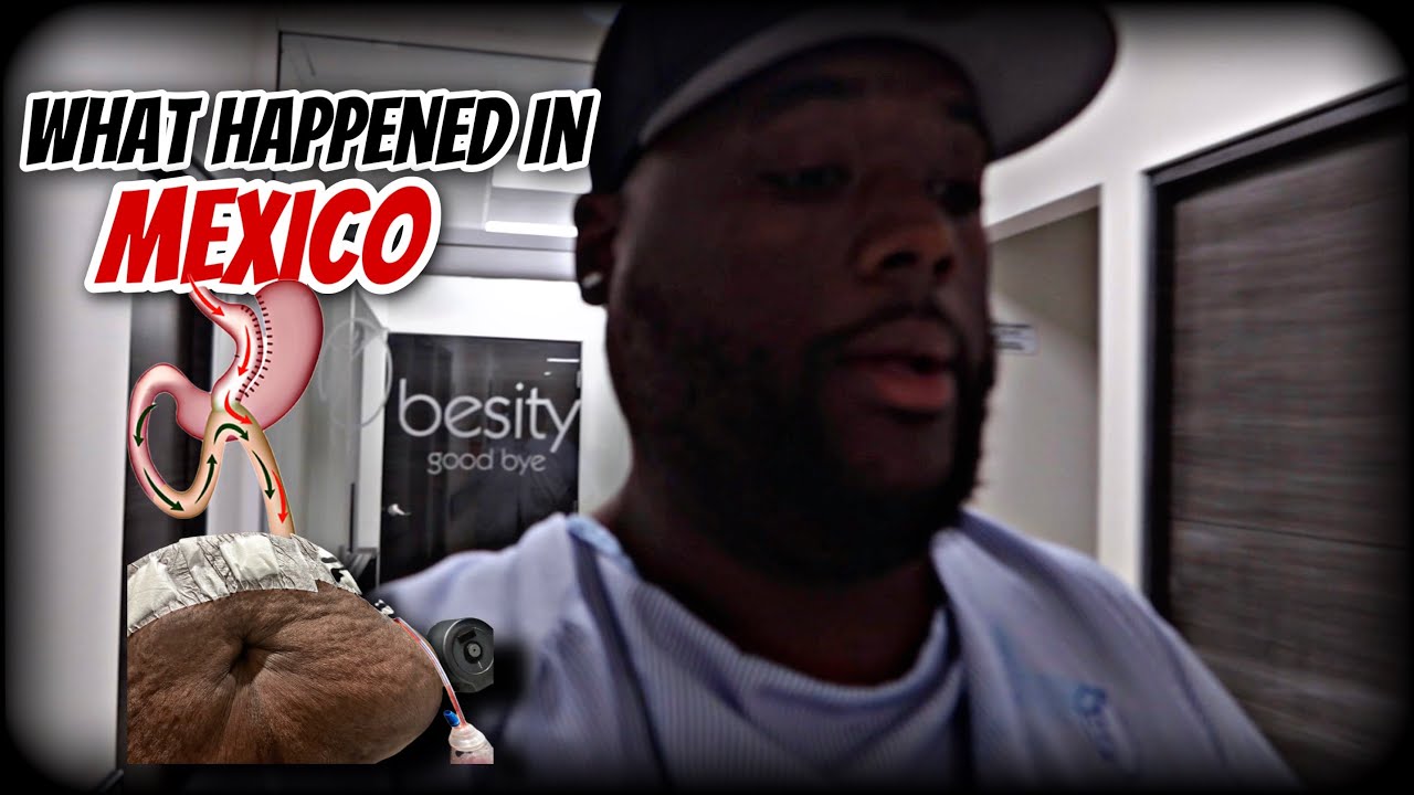 I Had Weight Loss Surgery Tijuana Mexico 💉😩 Obesity Goodbye Center 🇲🇽