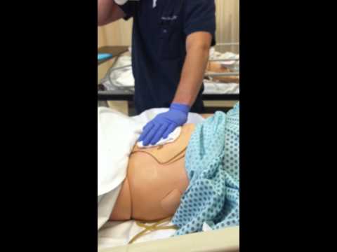 Coto Nursing Ostomy Care Skill