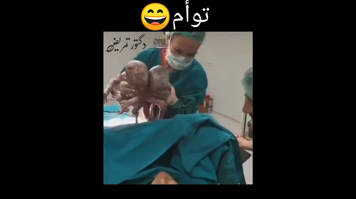 ردة فعل الأم بعد ولادة طفلين توأم 😄🌷