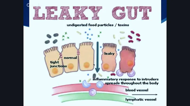 Leaky Gut: What Is It And Should You Be Concerned?