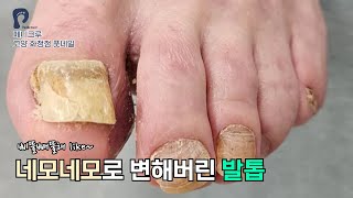 발톱이 네모네모 ?! 재활치료중이신 80대고객님 #oddlysatisfying #mostsatisfyingvideo