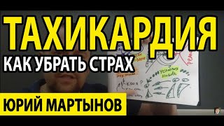 Тахикардия сердца и лечение | Экстрасистолия на ЭКГ | Тахикардия шум в ушах и что при этом делать