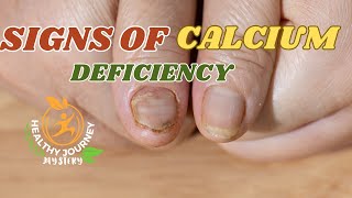 Signs of Calcium Deficiency In Females | Health Facts | Healthy Journey