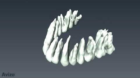 Amazing tooth segmentation video from FEI’s 3D visualization solution
