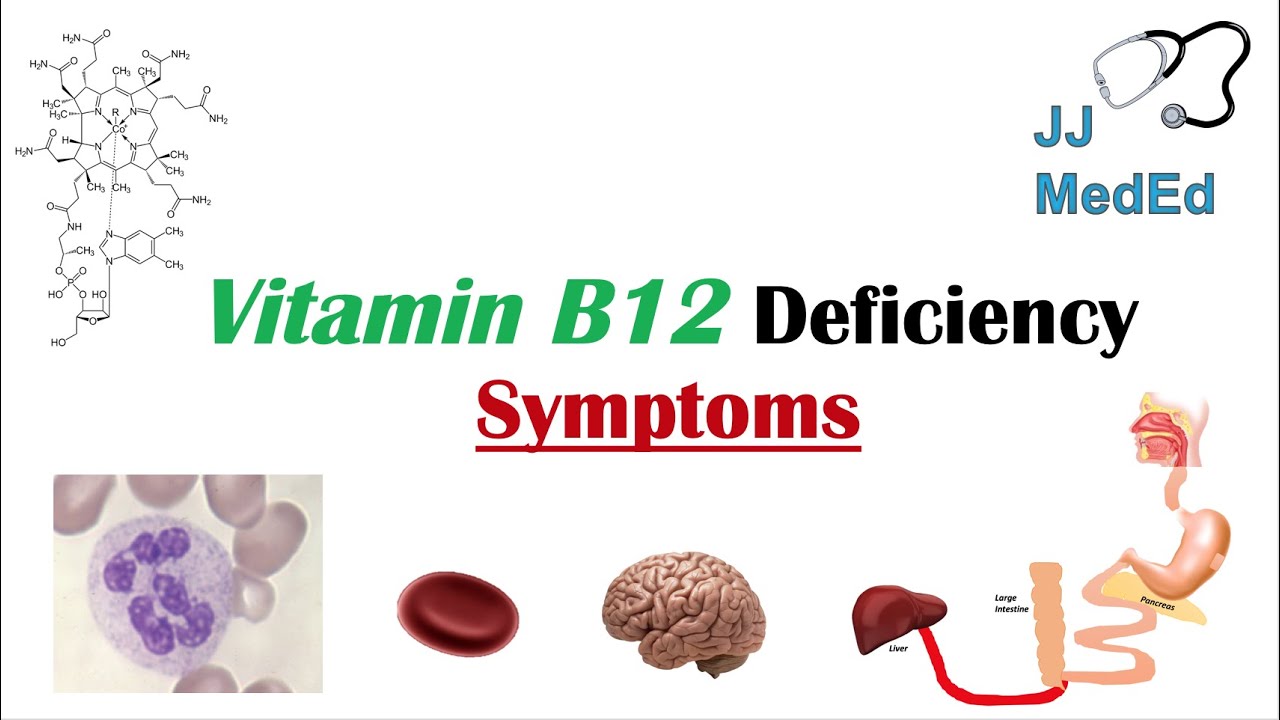 Vitamin B12 Deficiency Symptoms Ex Depression Why Symptoms Happen Schillings Test Treatment