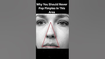 Why You Should Never Pop Pimples In This Area